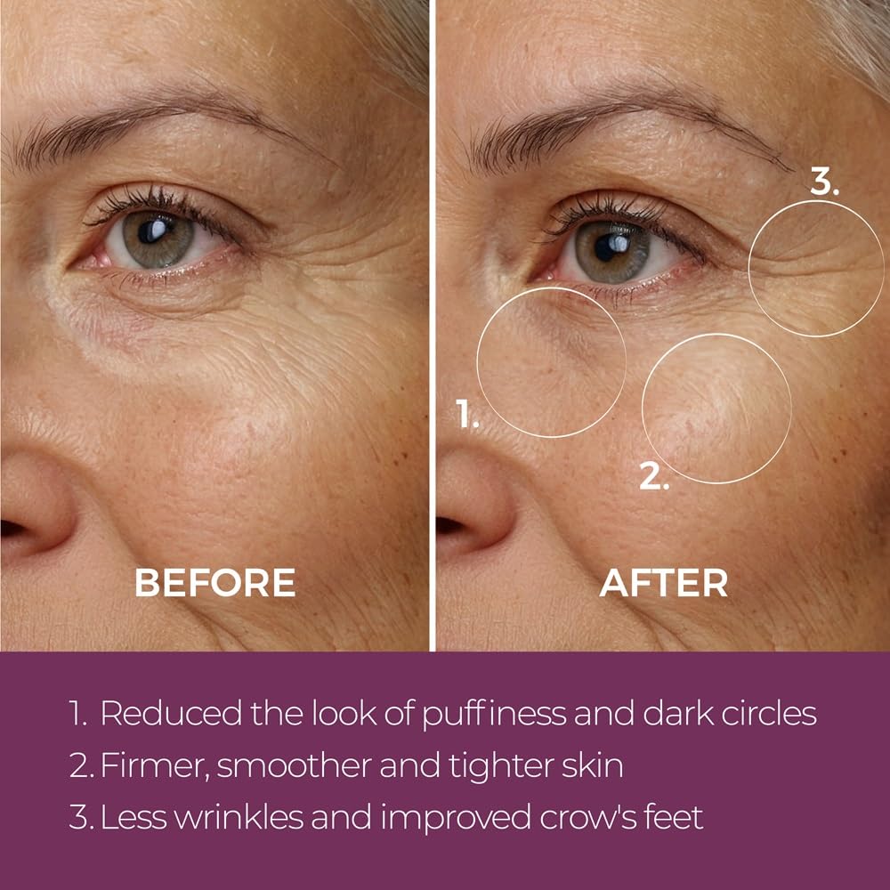 blinc Eye Repair Peptide Complex, Eye Cream for Dark Circles & Puffiness