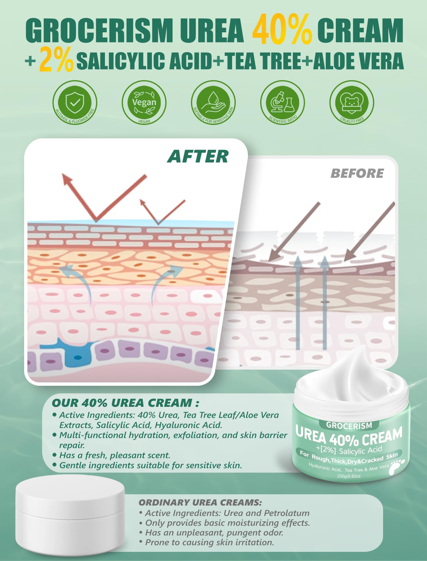 Urea Cream 20 Percent For Feet Plus 2% Salicylic Acid 150g || Foot Cream and Hand Cream Maximum Strength with Hyaluronic Acid, Tea Tree, and Aloe Vera for Deep Moisturizes