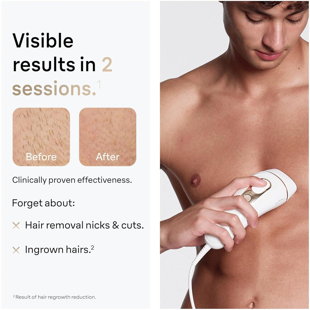 Braun IPL, Silk·Expert Pro 5, IPL Hair Removal for Women and Men, Permanent Laser Hair Reduction At-Home, 1 Head, IPL5100