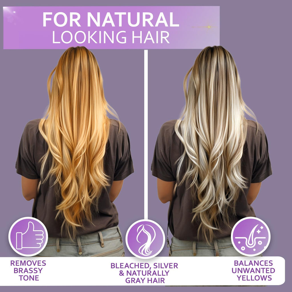 Apple Cider Vinegar Conditioner - Sulfate Paraben and Silicone Free - For Dry, Damaged and Oily Hair - Anti Dandruff Product for Fine Itchy Scalp Build Up - Cleansing Treatment for Women and Men