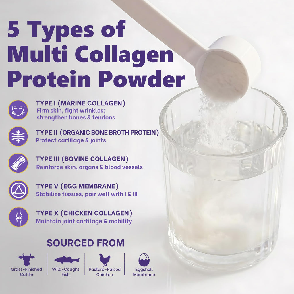 Zammex Multi Collagen Protein Powder, Type I & III & V & X, Hydrolyzed Collagen Peptides for Women & Men, Supports Hair and Skin, Gut Health, 41 Servings, Chocolate