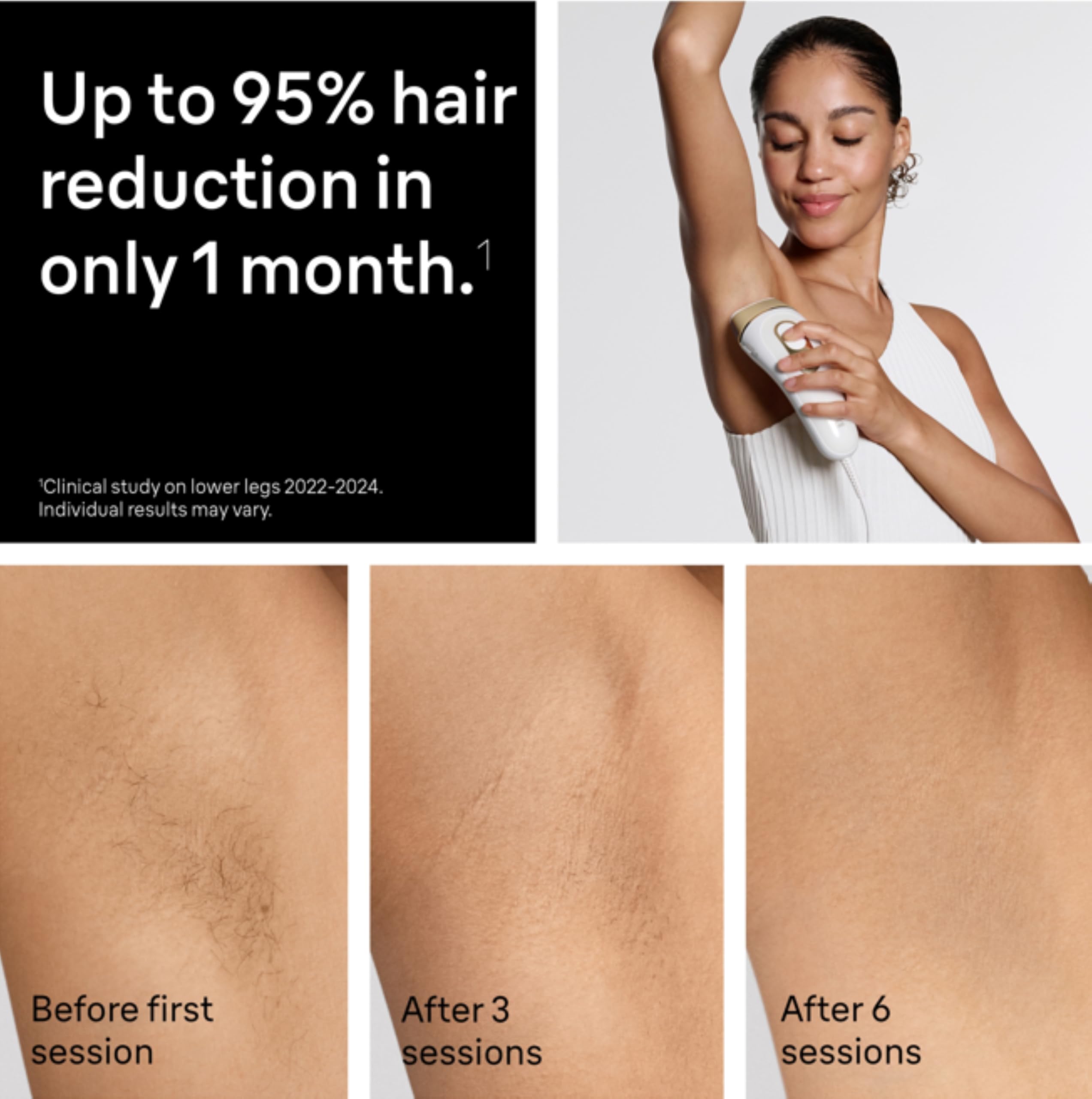 Braun IPL, Silk·Expert Pro 5, IPL Hair Removal for Women and Men, Permanent Laser Hair Reduction At-Home, 1 Head, IPL5100