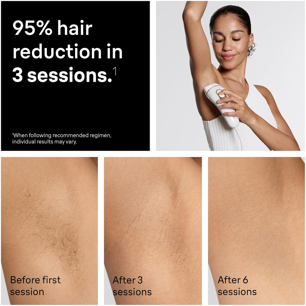 Braun IPL, Silk·Expert Pro 5, IPL Hair Removal for Women and Men, Permanent Laser Hair Reduction At-Home, 1 Head, IPL5100