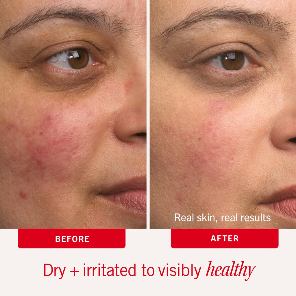 First Aid Beauty Ultra Repair Cream, Intense Hydration Face & Body Moisturizer with Colloidal Oatmeal, Helps Relieve Eczema, Dry Skin Barrier Repair, Fragrance Free